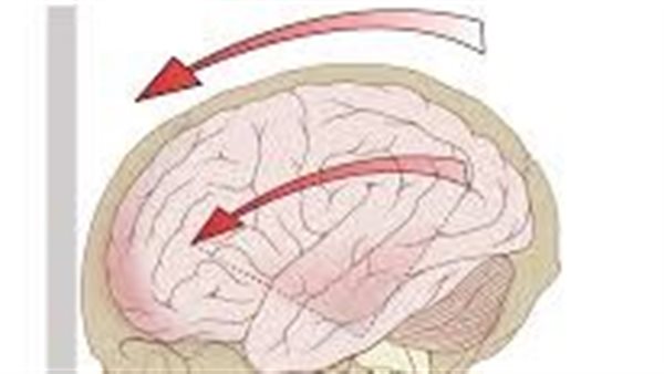 علامات الاصابة بارتجاج المخ