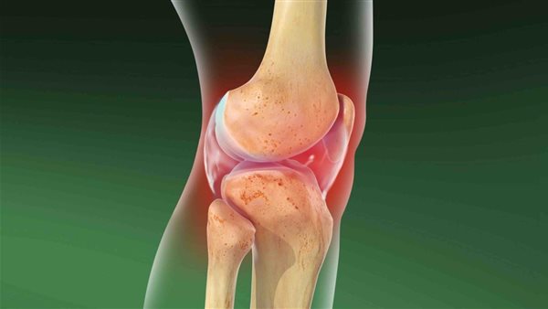 مادة حيوية جديدة تعيد نمو الغضروف التالف في المفاصل