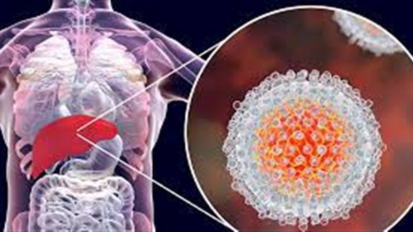 التهاب الكبد الوبائي A عند الأطفال.. تعرفي على الأسباب والأعراض والمضاعفات والعلاج